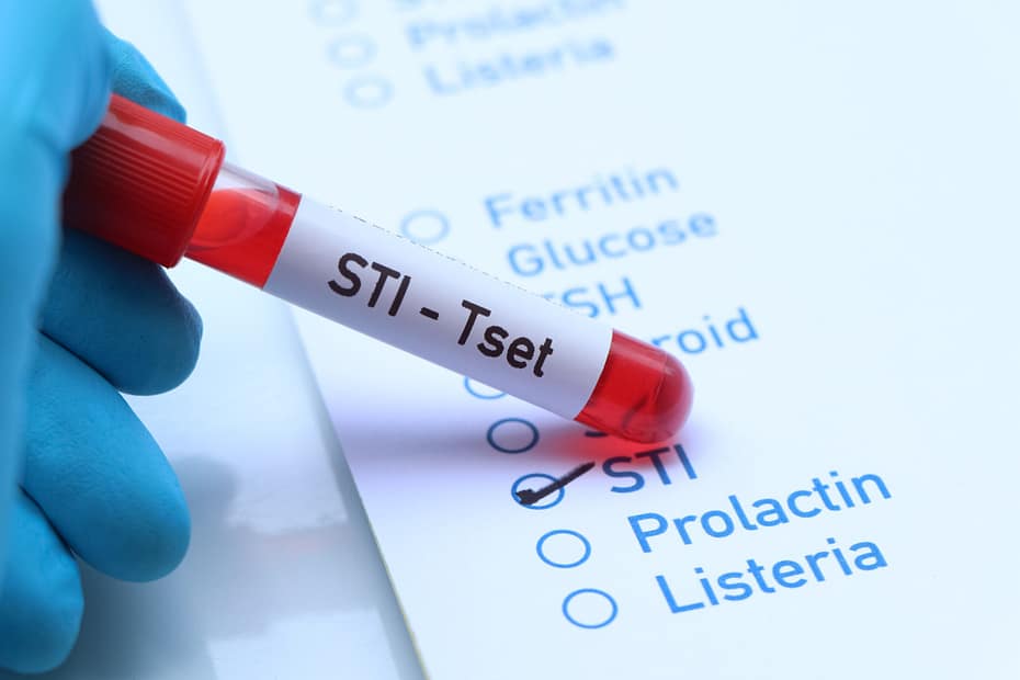 Picture showing a test tube stating "STI-Test" representing STI Testing in the Swinger Lifestyle.